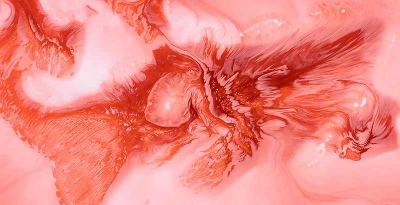 Intrahepatic-Cholangiocarcinoma