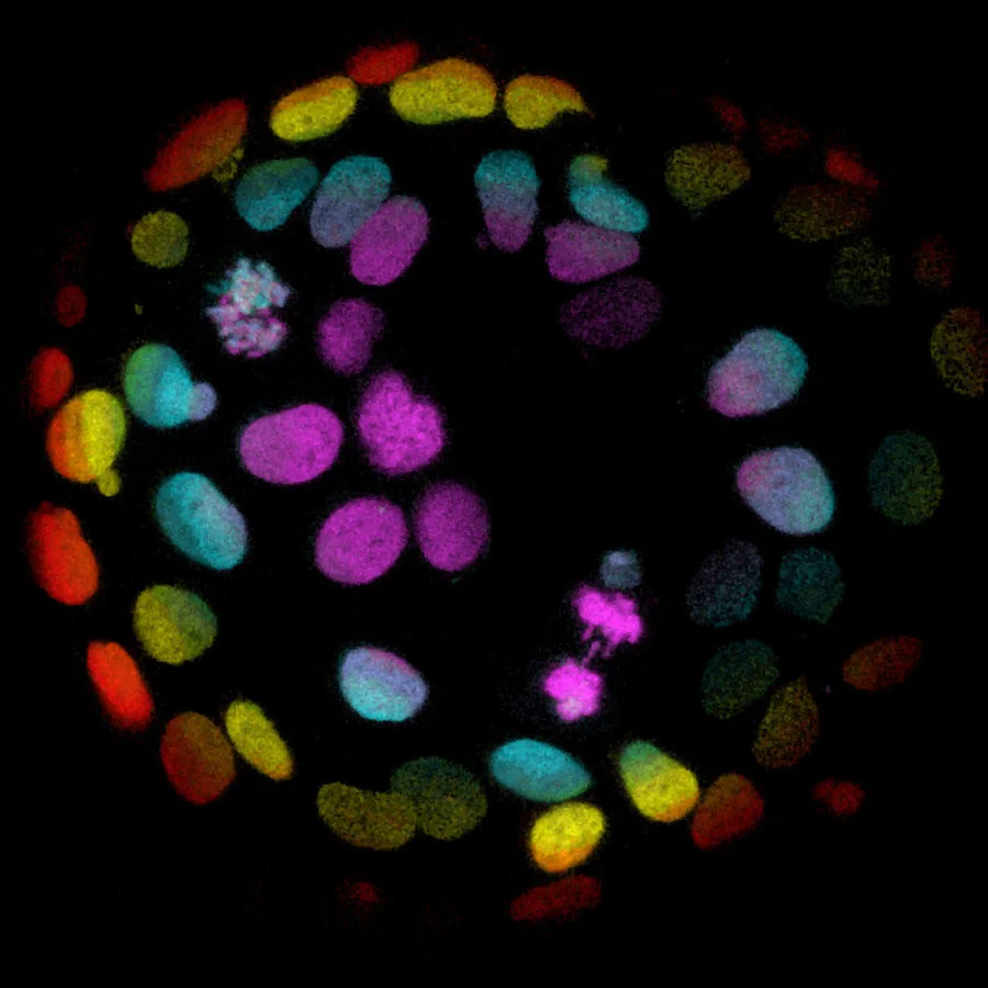 colorectal-organoid-article