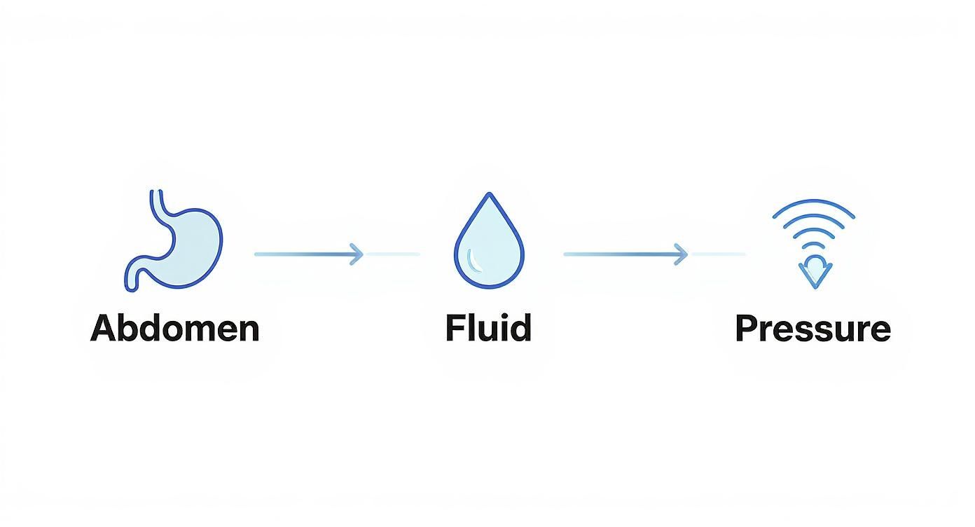 Medical diagram showing progression from abdomen to fluid accumulation to pressure in ascites condition