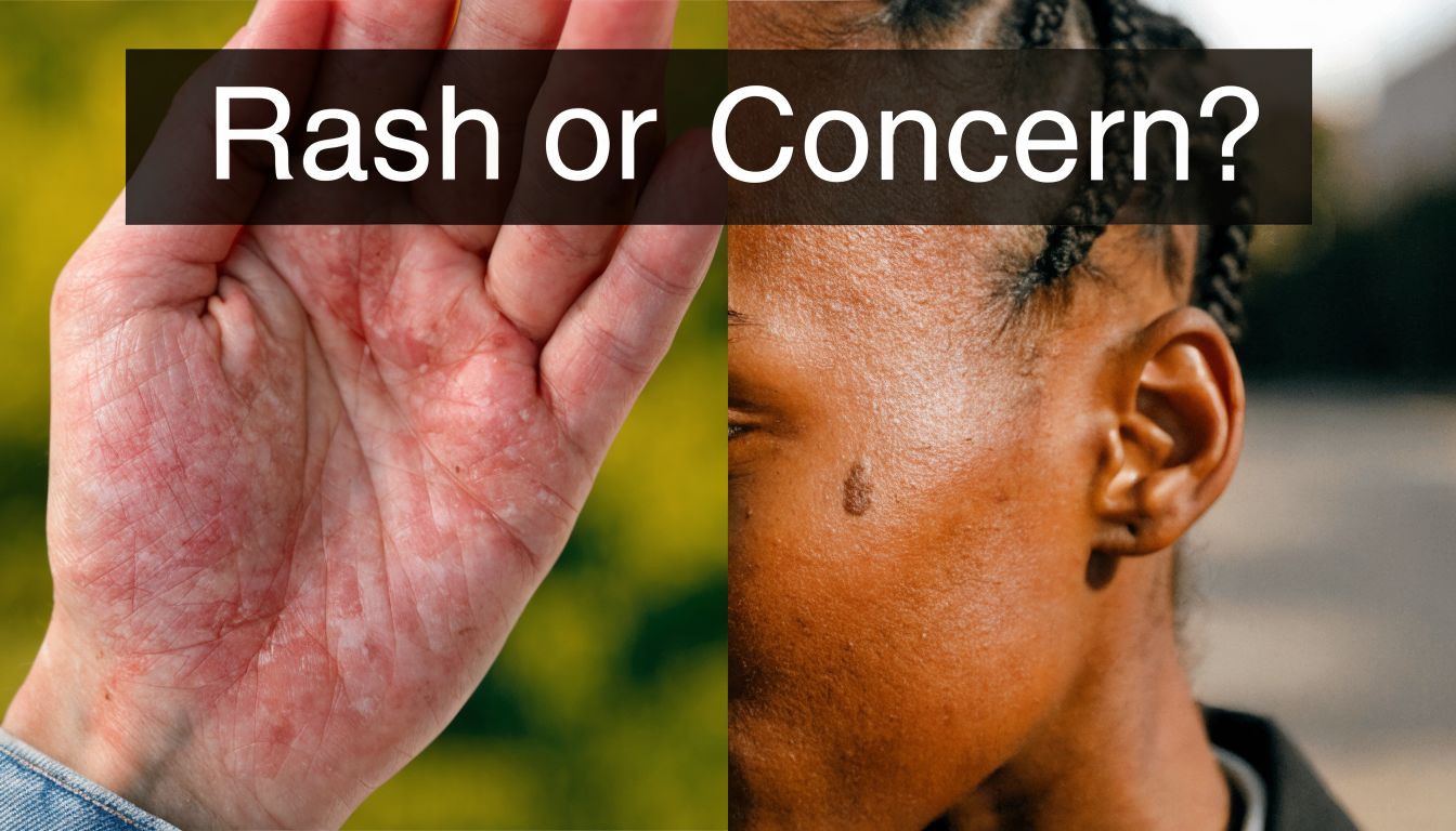 A split-screen image showing a red rash on a hand and a skin mole on a face.