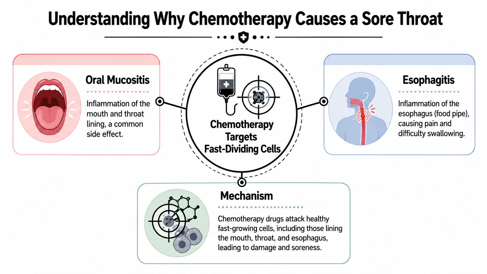 An infographic explaining how chemotherapy causes sore throats through oral mucositis and esophagitis by damaging fast-dividing cells.