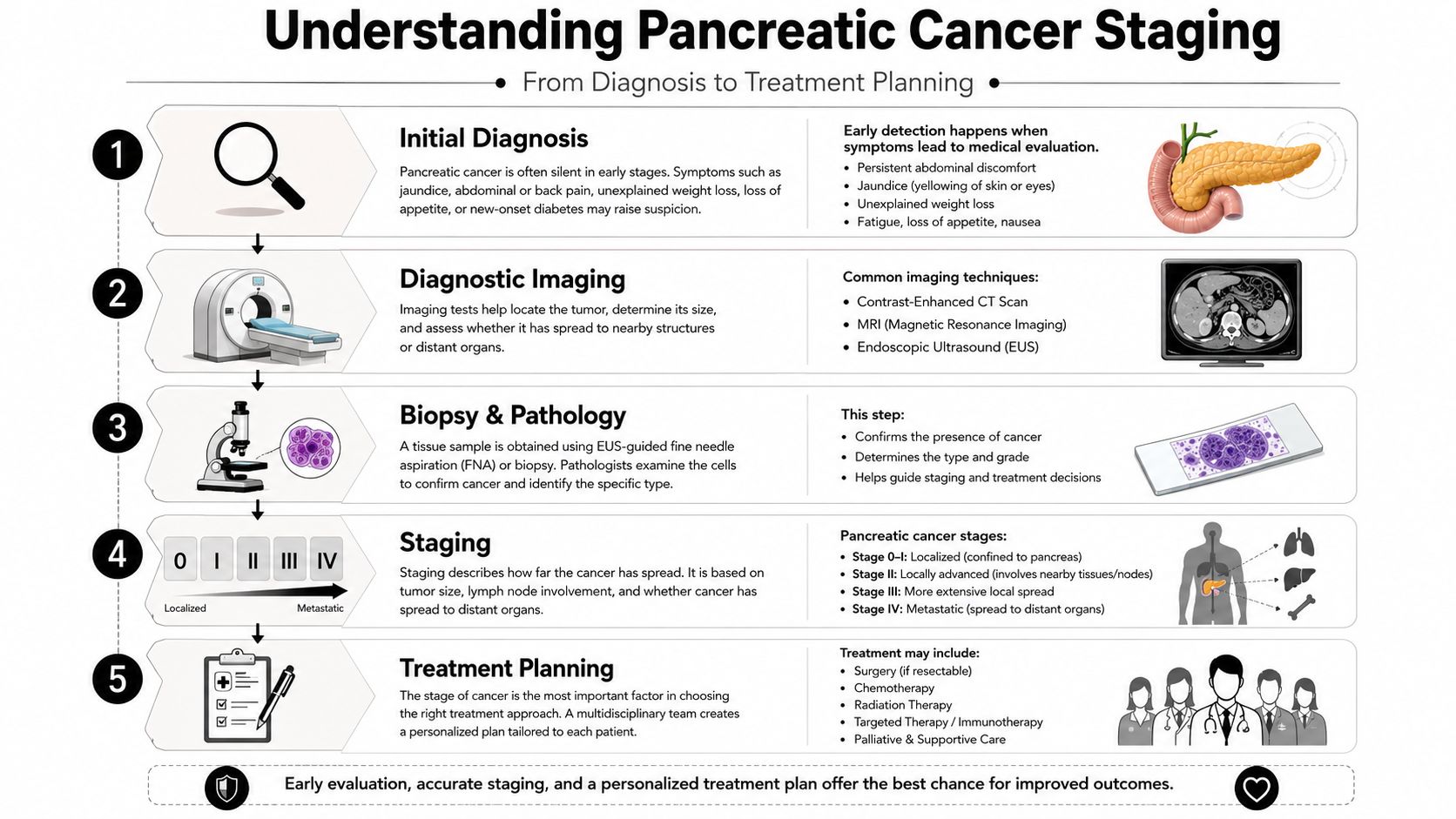 A diagram illustrating the five-step process of pancreatic cancer diagnosis, staging, and personalized treatment planning.