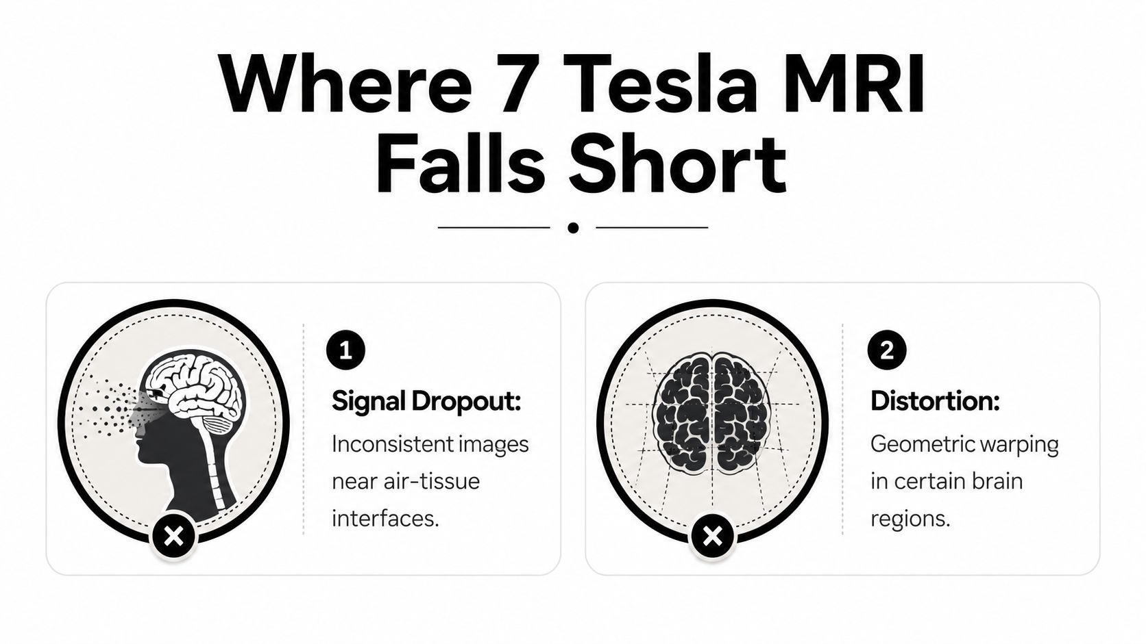 An infographic titled Where 7 Tesla MRI Falls Short, illustrating signal dropout and image distortion challenges.