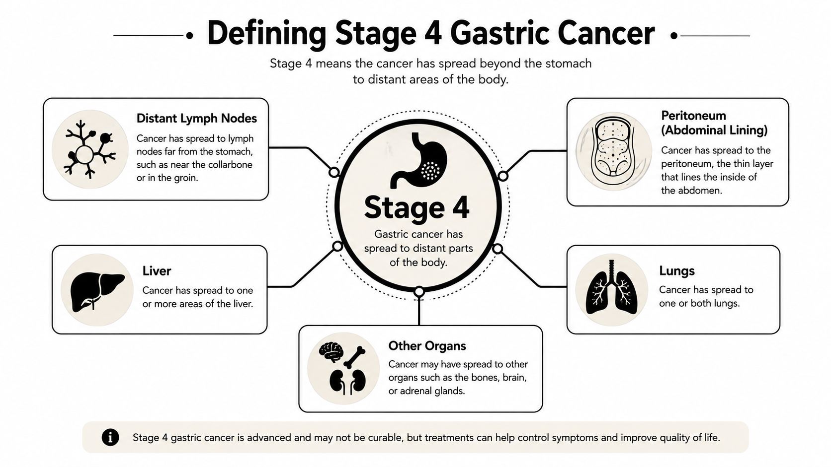 A diagram explaining Stage 4 gastric cancer, showing how it spreads to distant organs and tissues.