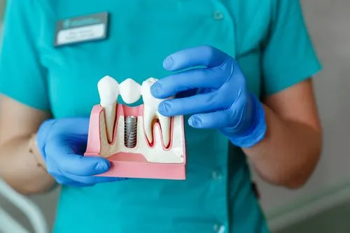dentist holding tooth model