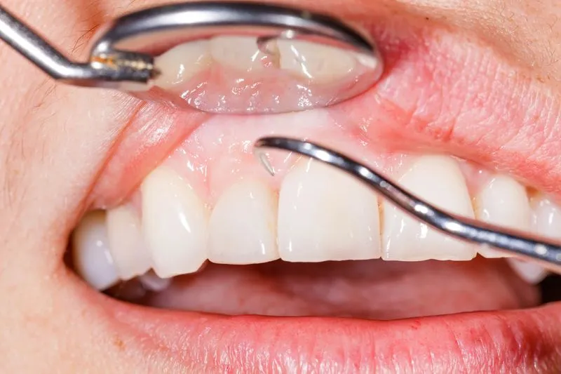 person getting gums checked