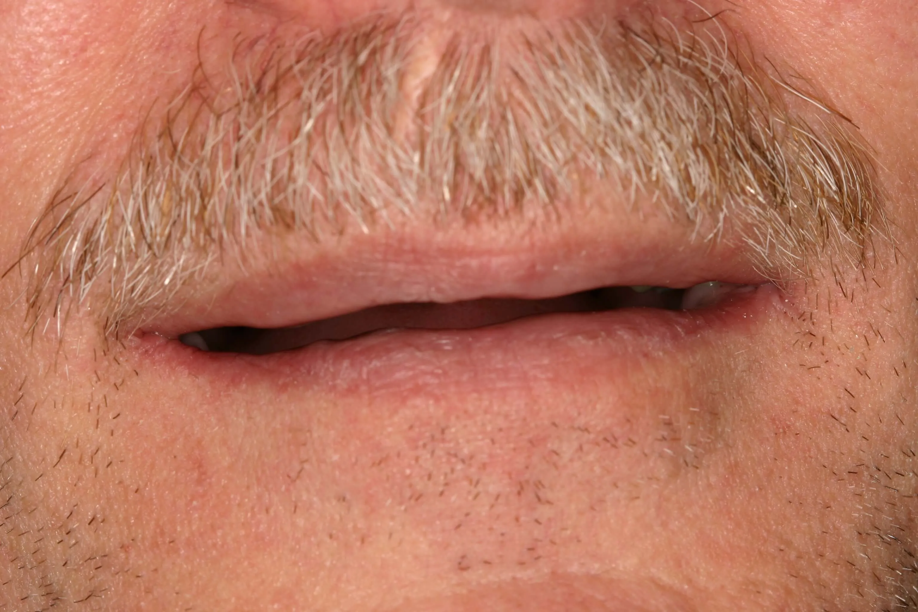 patient's mouth before treatment