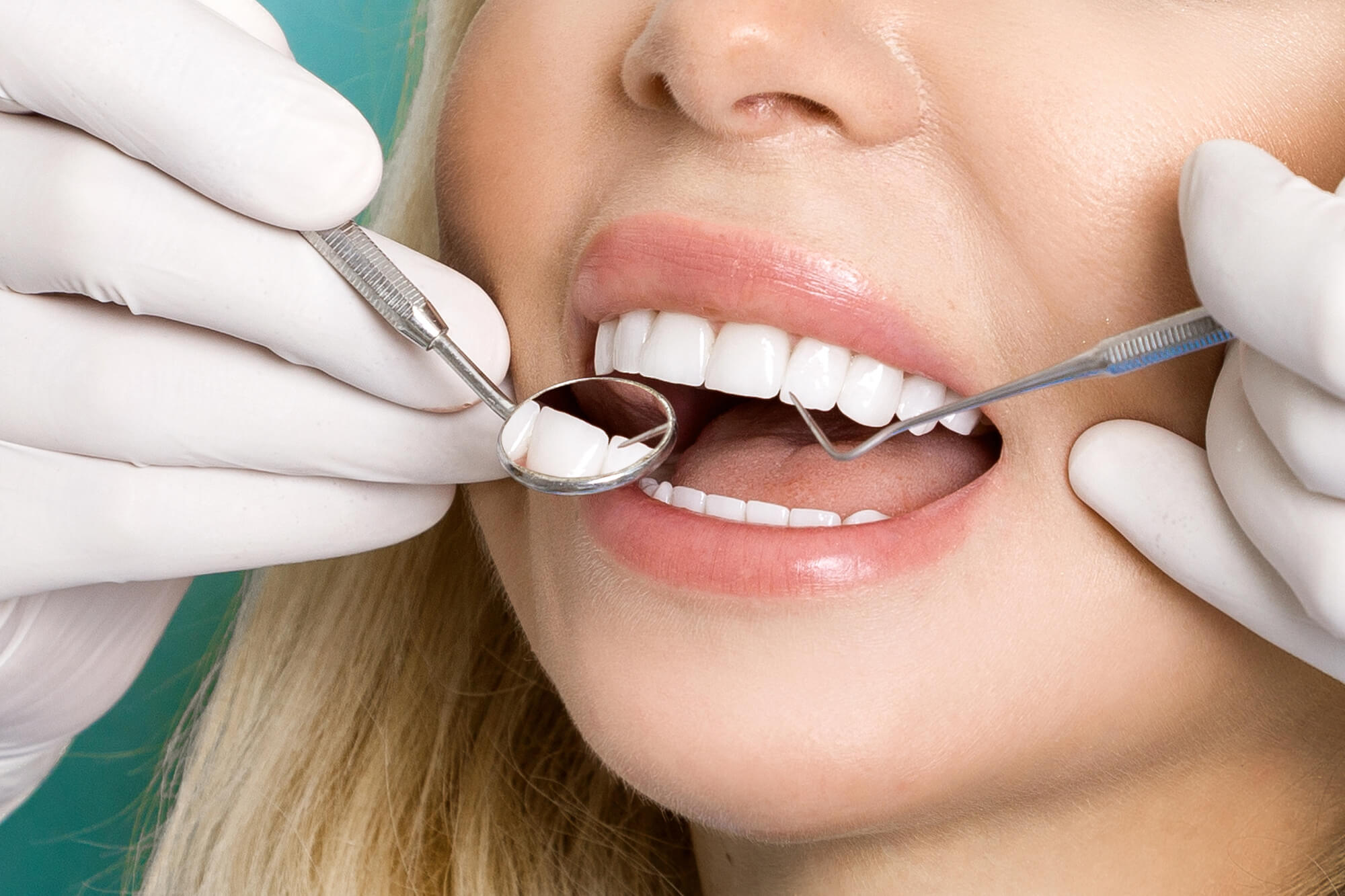 dentist assessing dental implant restorations