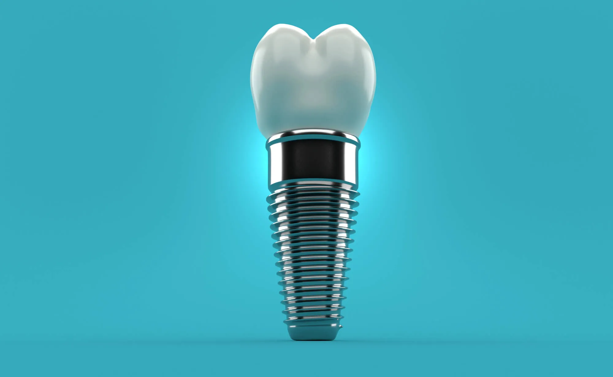 single dental implant norfolk va