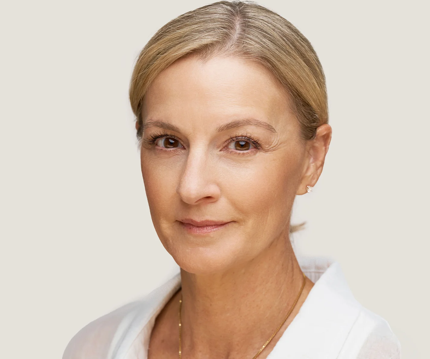 Middle-aged woman with skin that has restored collagen and volume enhancement.