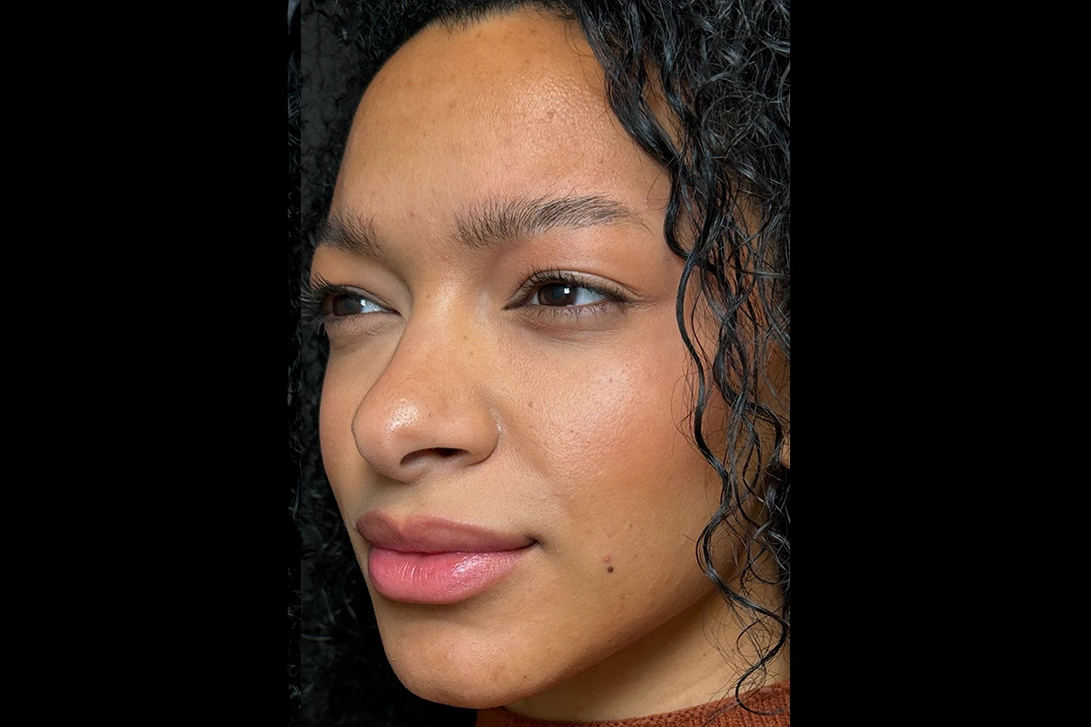 Middle-aged woman after wrinkle relaxer