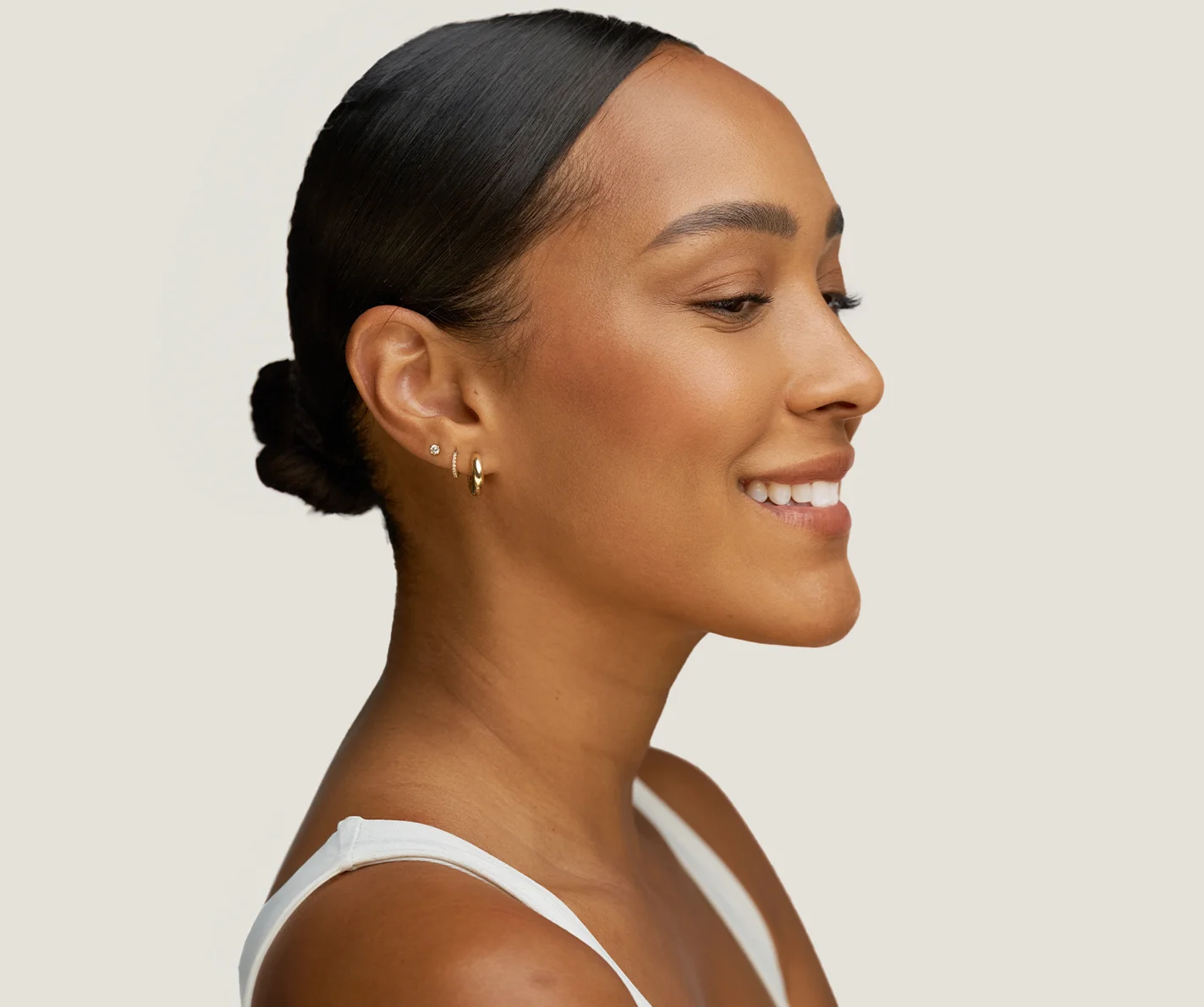 Young woman with defined facial structure and chin contour that is free of submental fullness. 