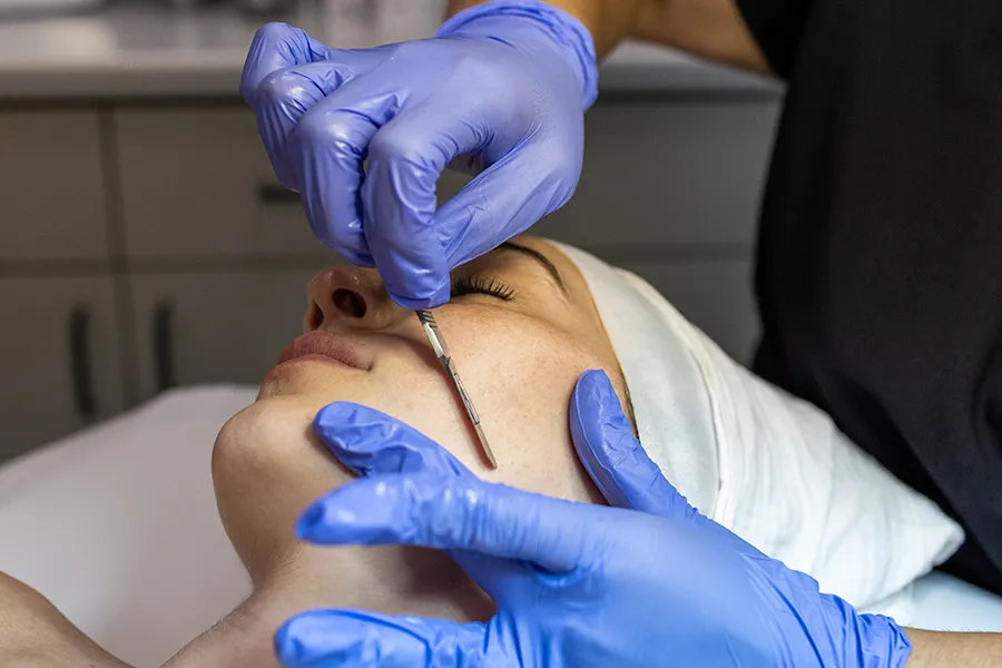 Young woman receiving dermaplaning treatment on the side of her lower cheek. 
