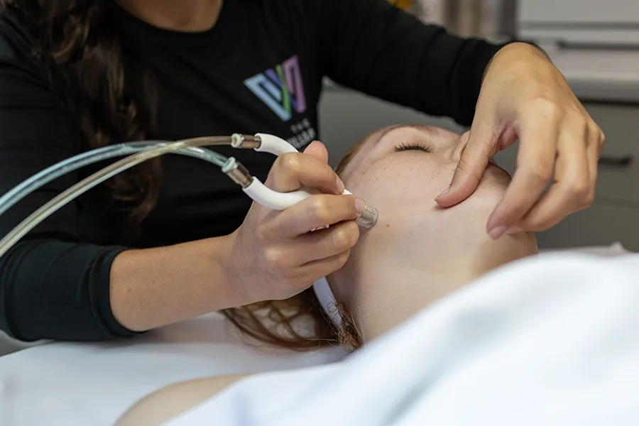 Young woman receiving microneedling treatment on her jaw. 
