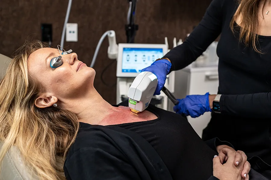 Middle-aged woman receiving BBL® HERO™ laser treatment on her décolleté area. 