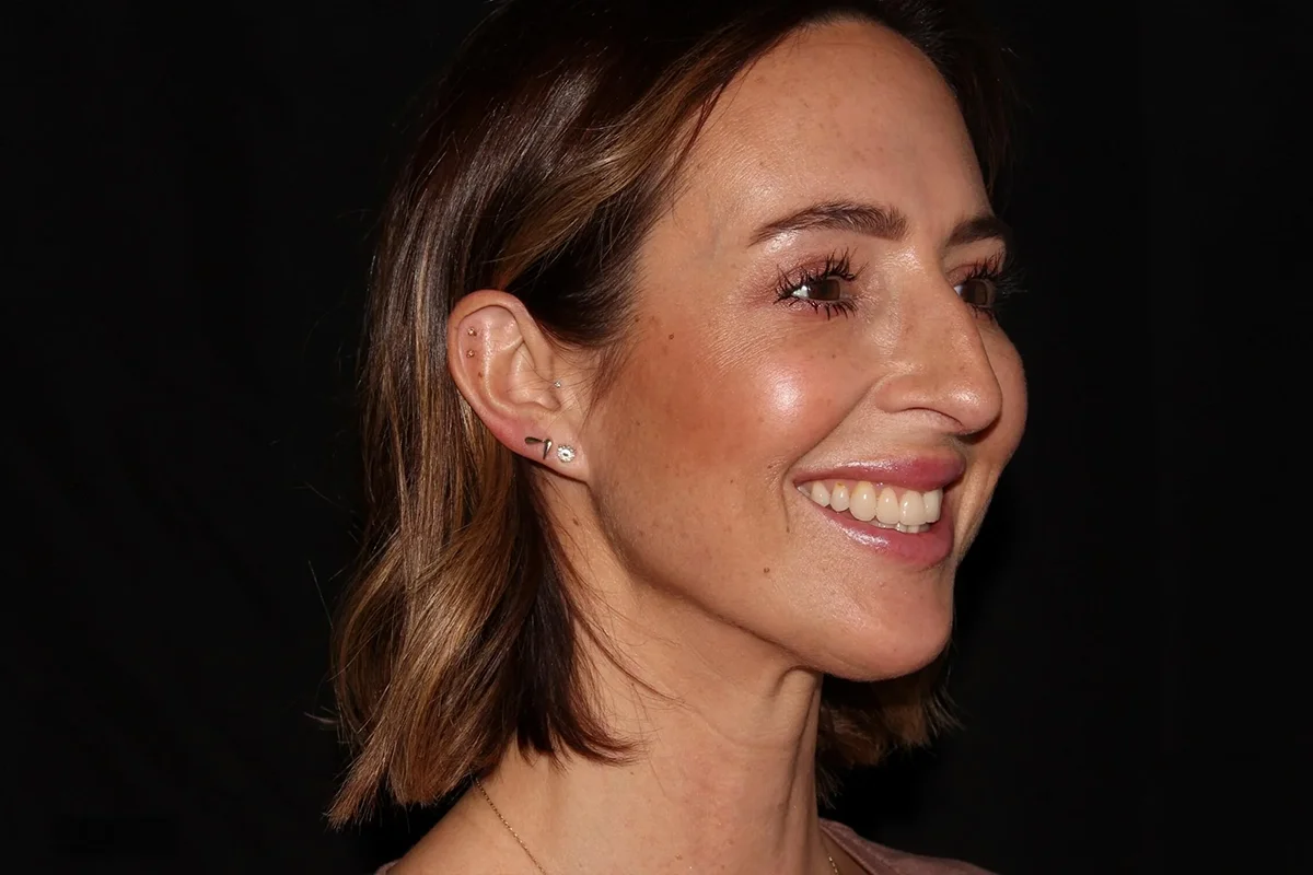 Middle-aged woman after neurotoxin and filler