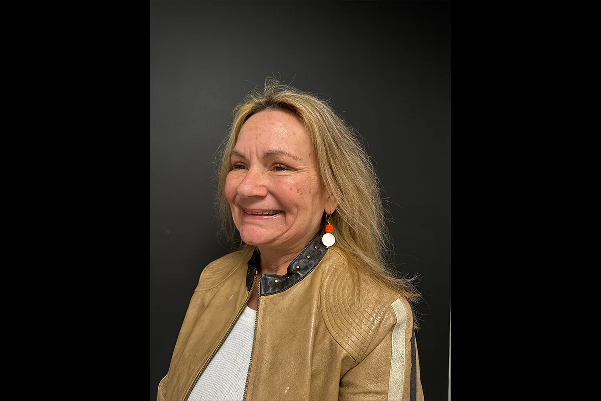 Older woman before facial filler