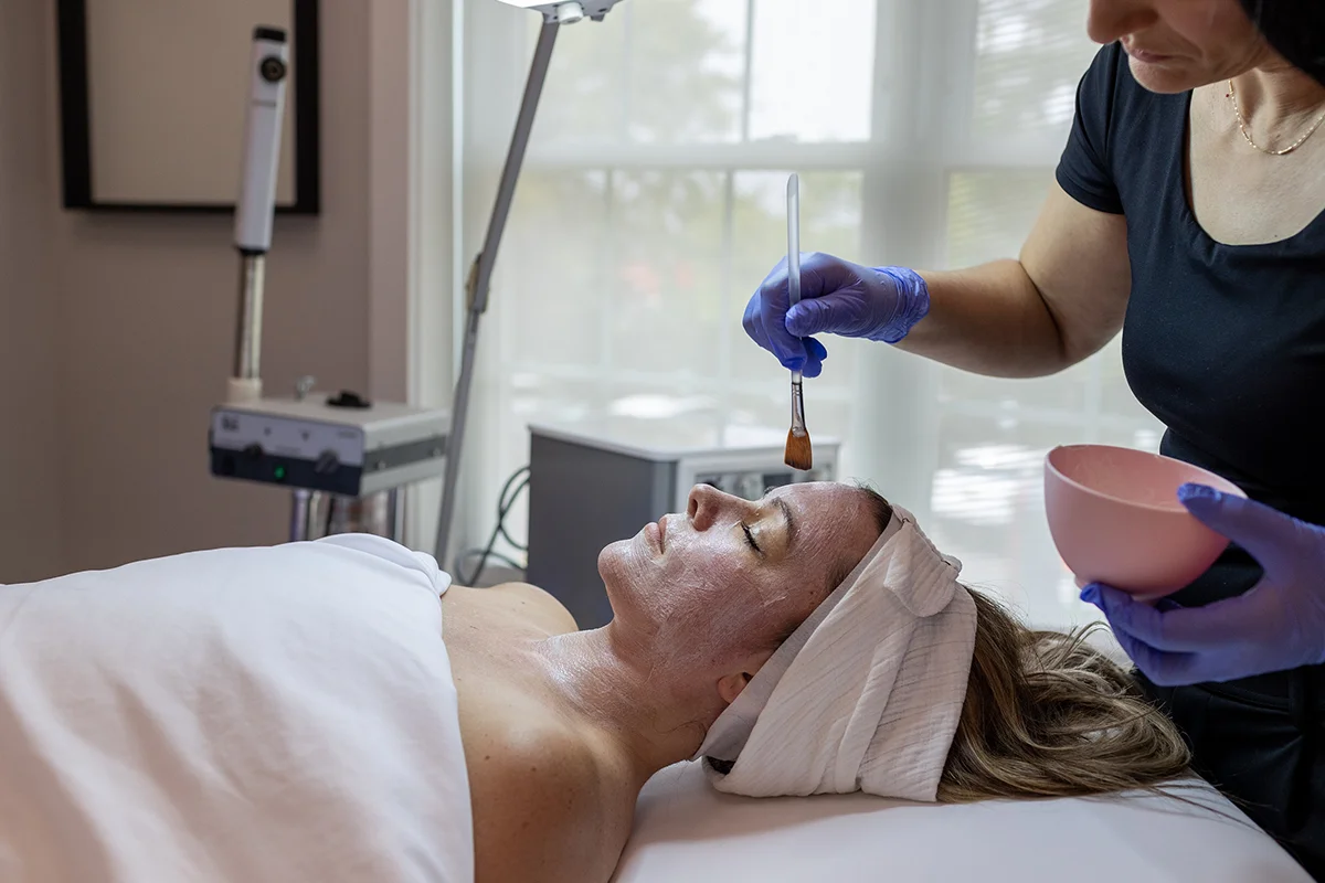 Young woman receiving a TCA chemical peel on her face. 
