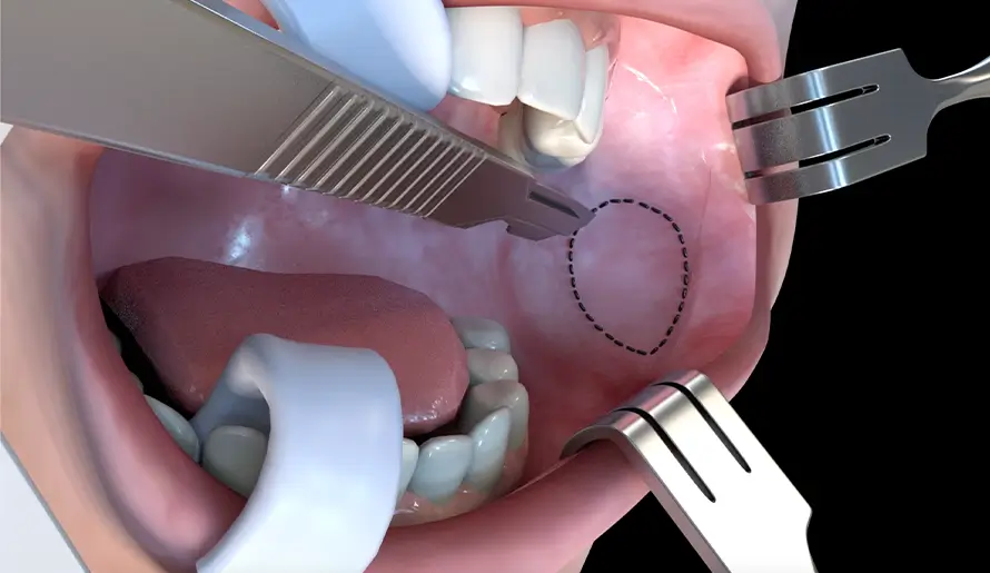Surgical Simulators for Training in New Surgical Techniques