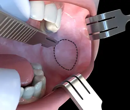 Screenshot from surgical simulator created by Dr Eugenia OKelly