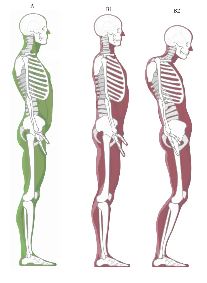 Spinal health and posture
