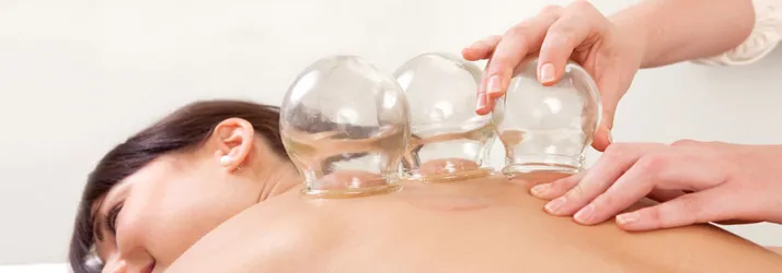 reputable cupping clinic