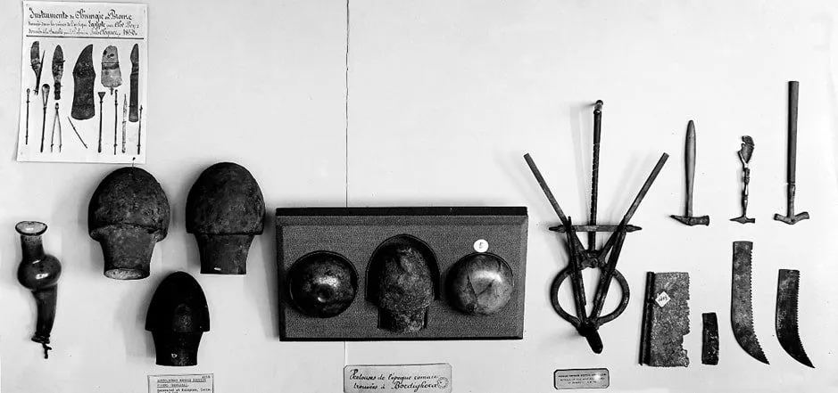 History of cupping therapy traditional uses