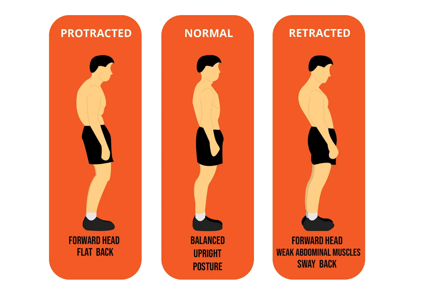 postural assessment in rehabilitation