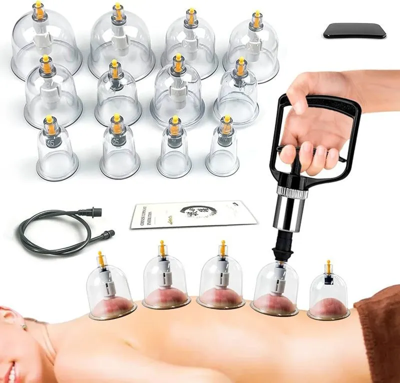 cupping therapy for back pain relief