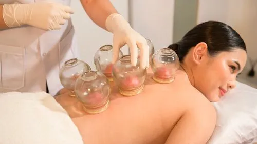 Regulation of cupping therapy