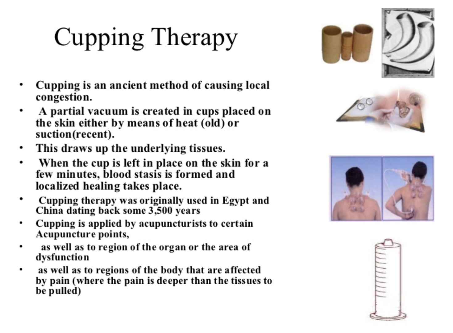 Cupping therapy scientific explanation