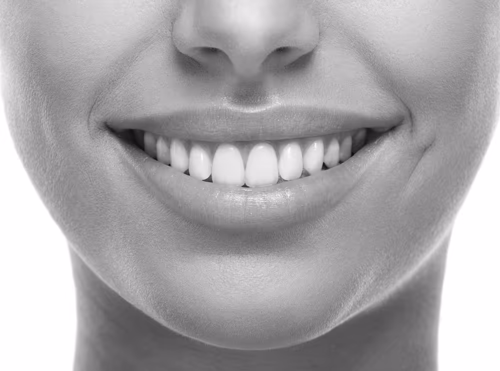 Aesthetic smile photo