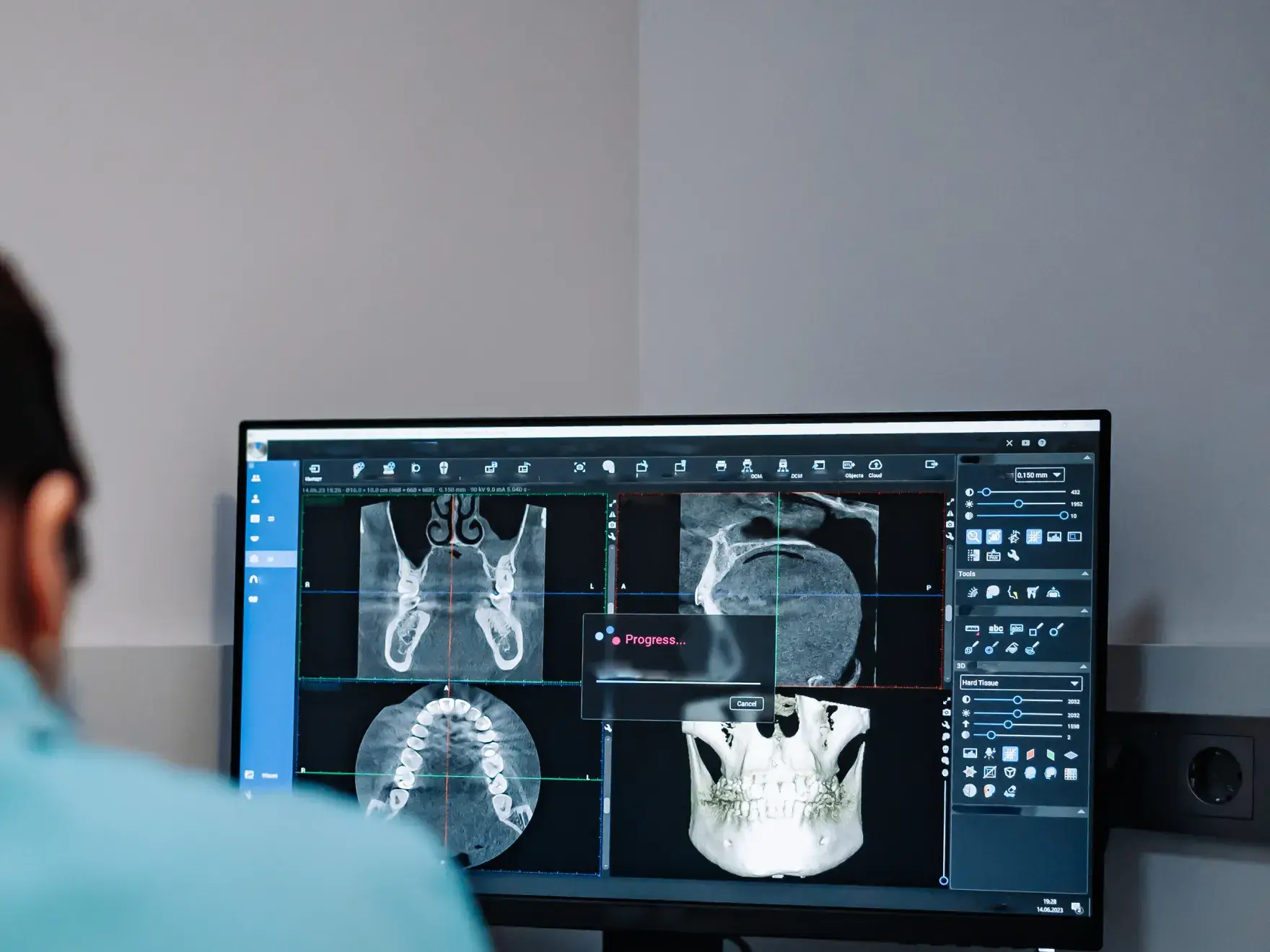 A man looking at a computer screen with x - ray images on it.