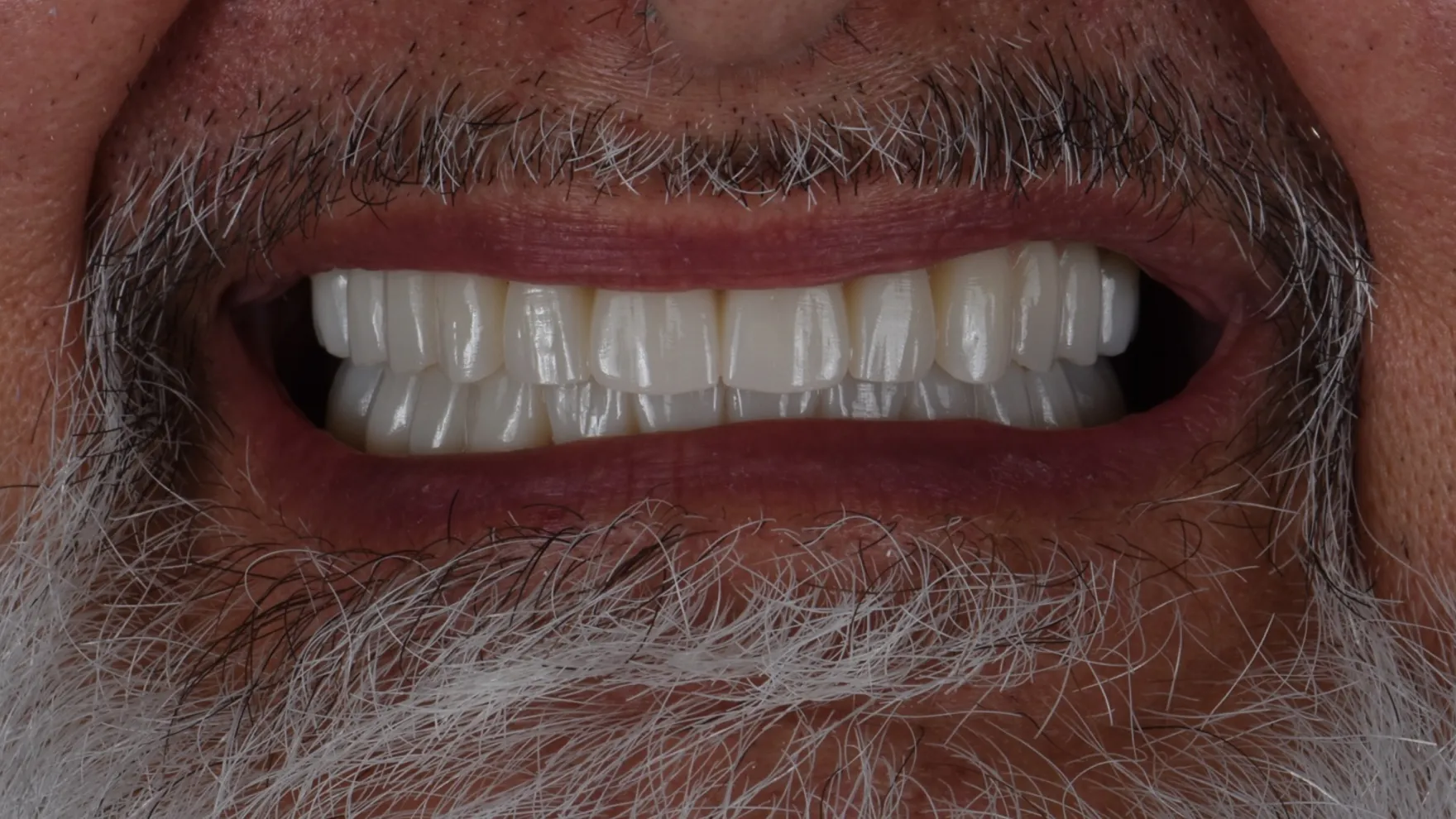 Treatment After