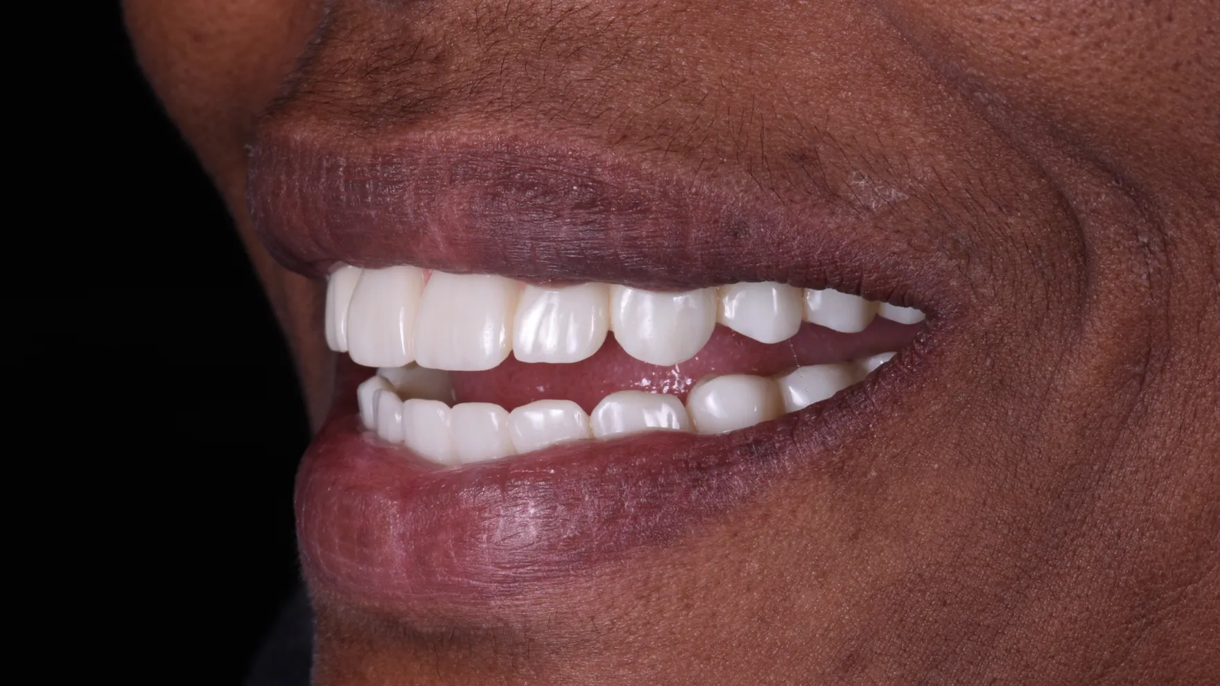 Treatment After