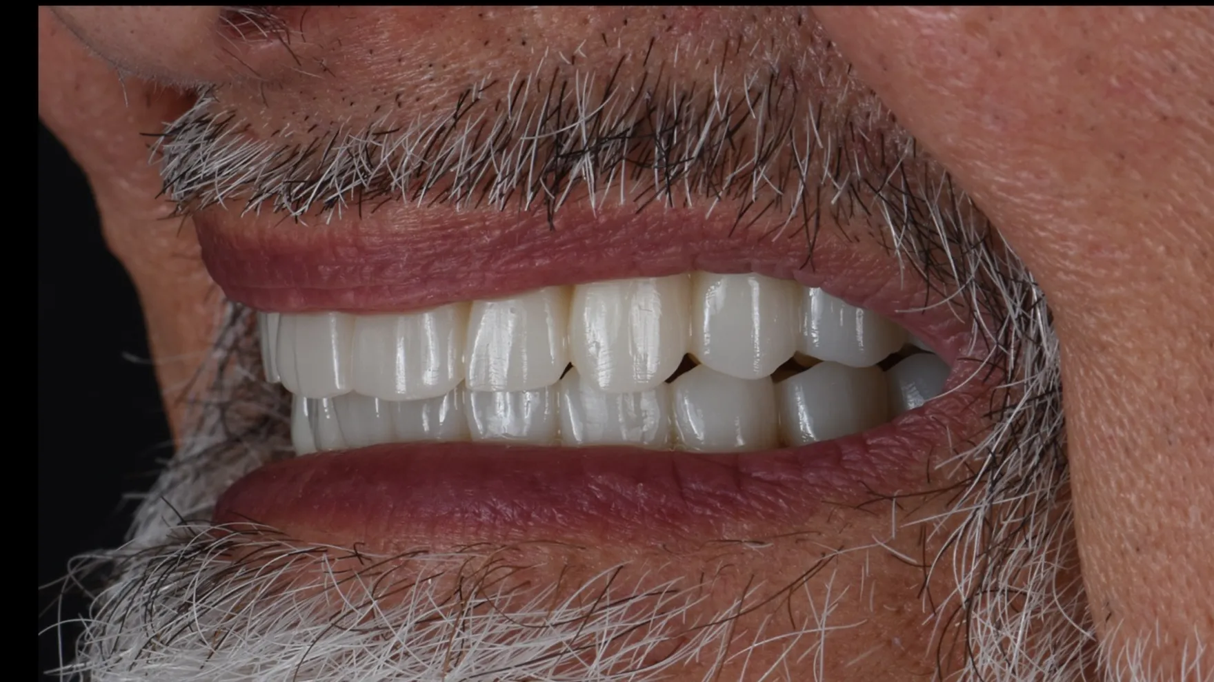Treatment After