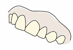 Représentation graphique de dents jaunes