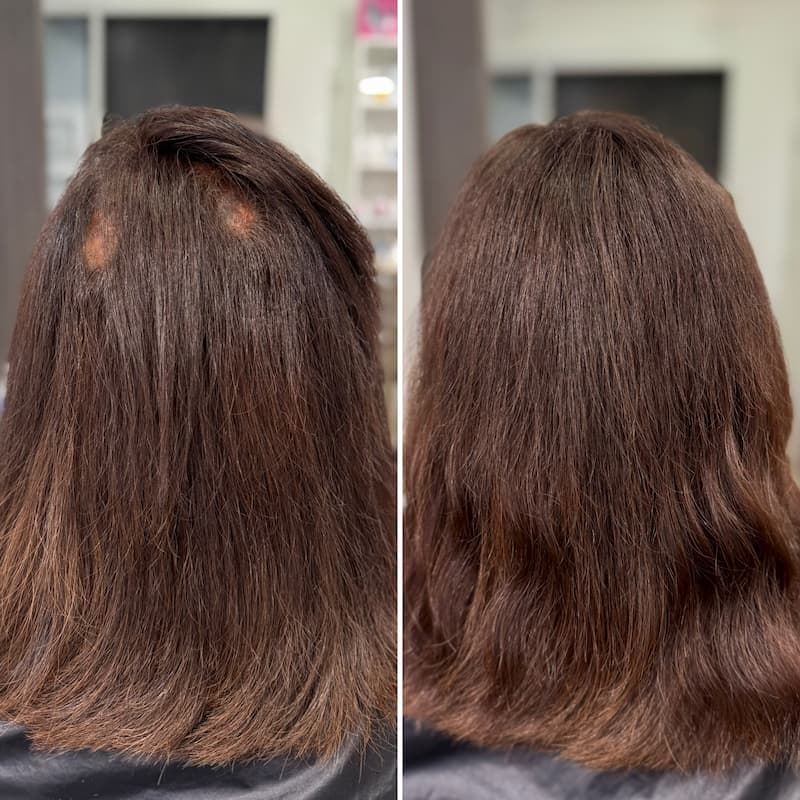 Hair extensions in Houston covering alopecia spots and thinning areas.