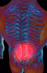 new york spinal cord injury attorney