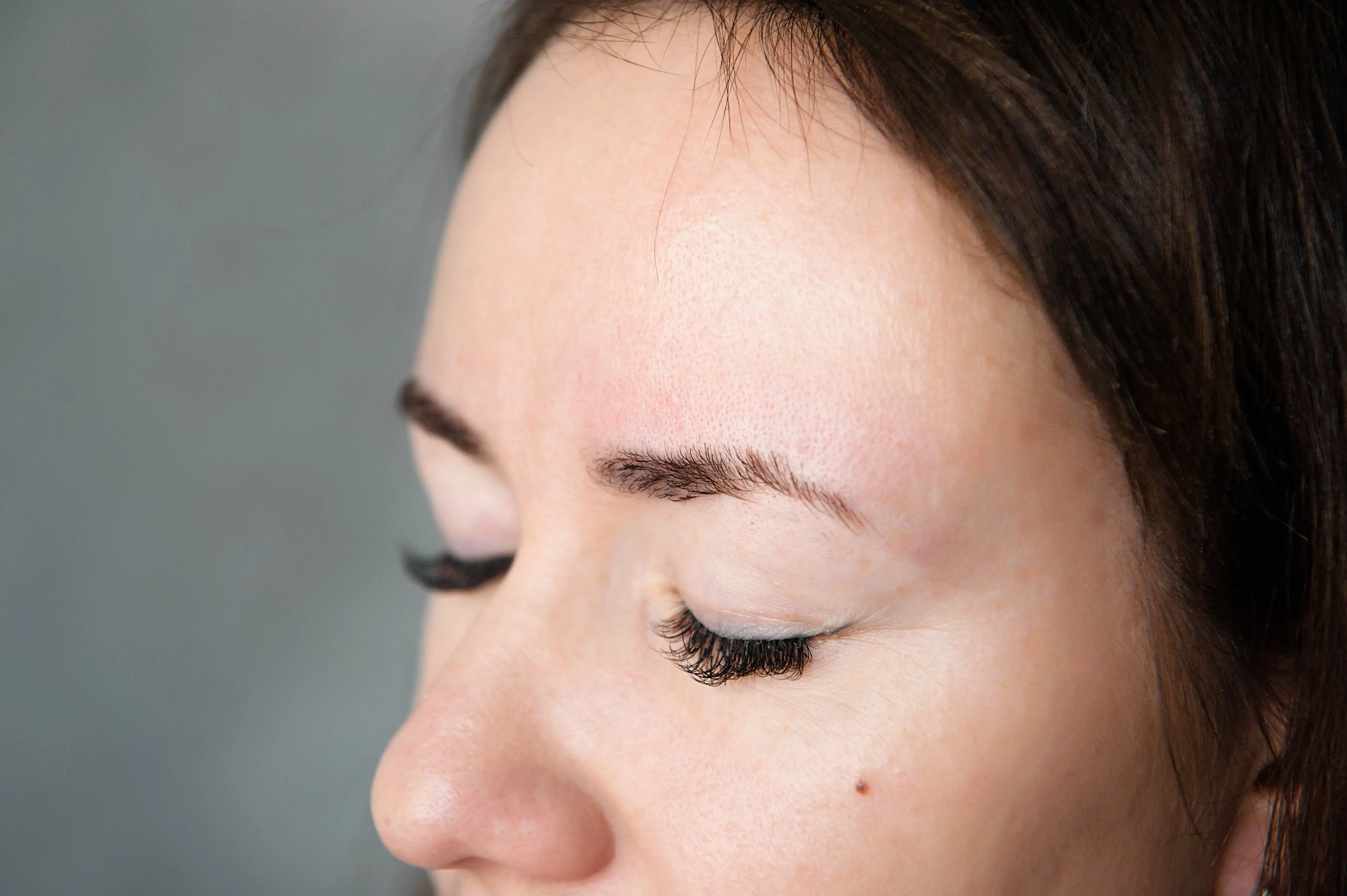 Introducing The Perfect Derma Peel