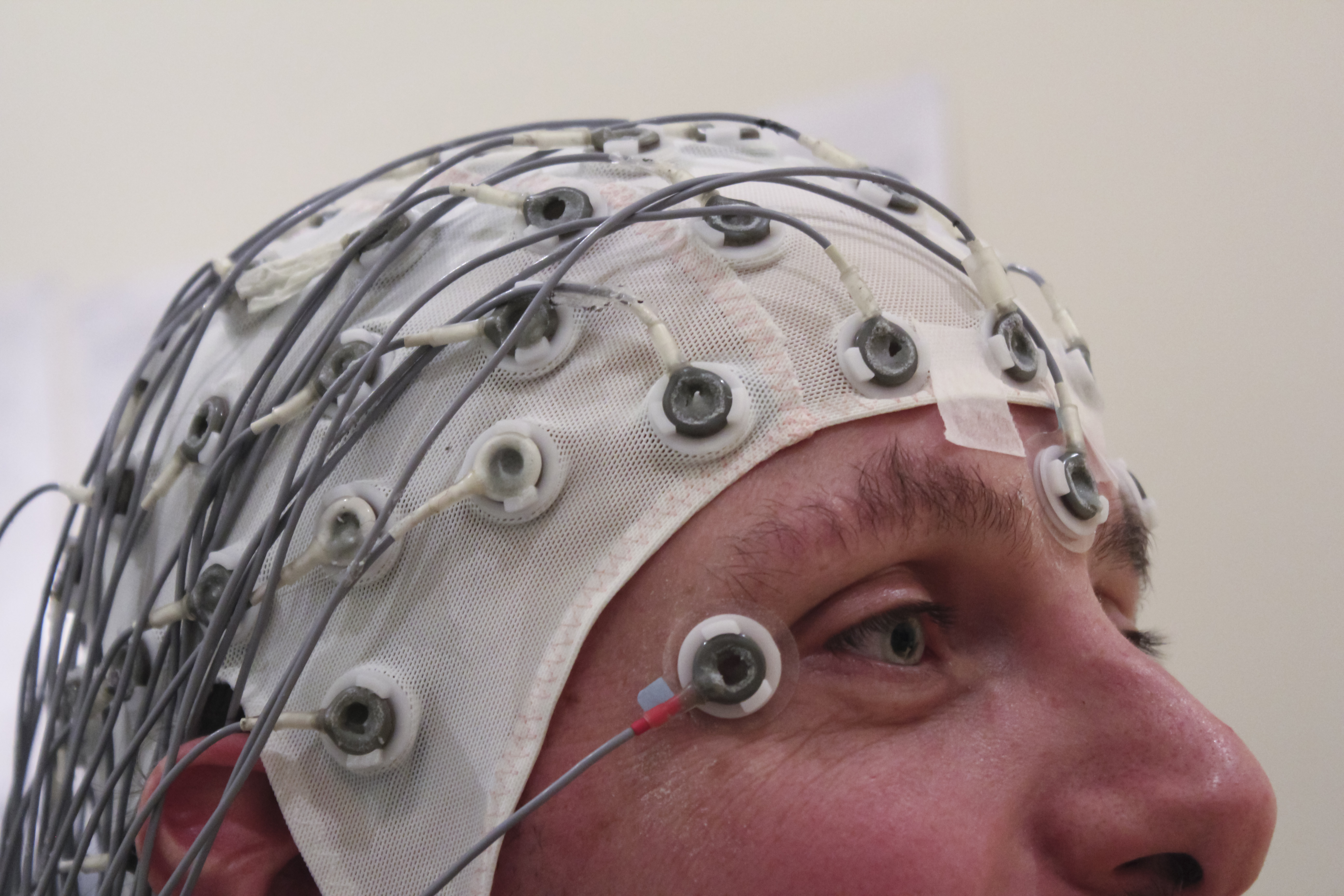 An electrode cap that helps record an EEG, which measures electrical activity from the brain ("EEG Recording Cap" by Chris Hope / CC BY 2.0 via Wikimedia Commons)