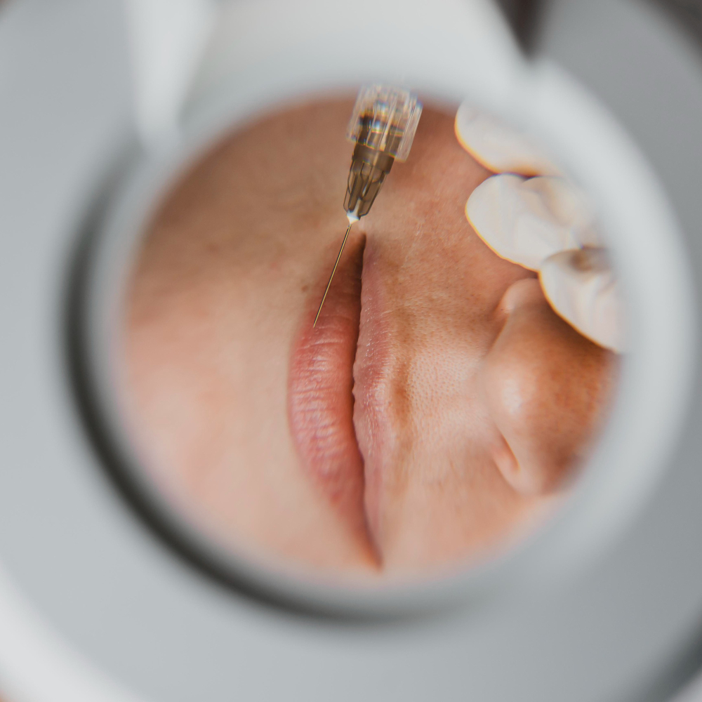 women-receiving-lip-injections