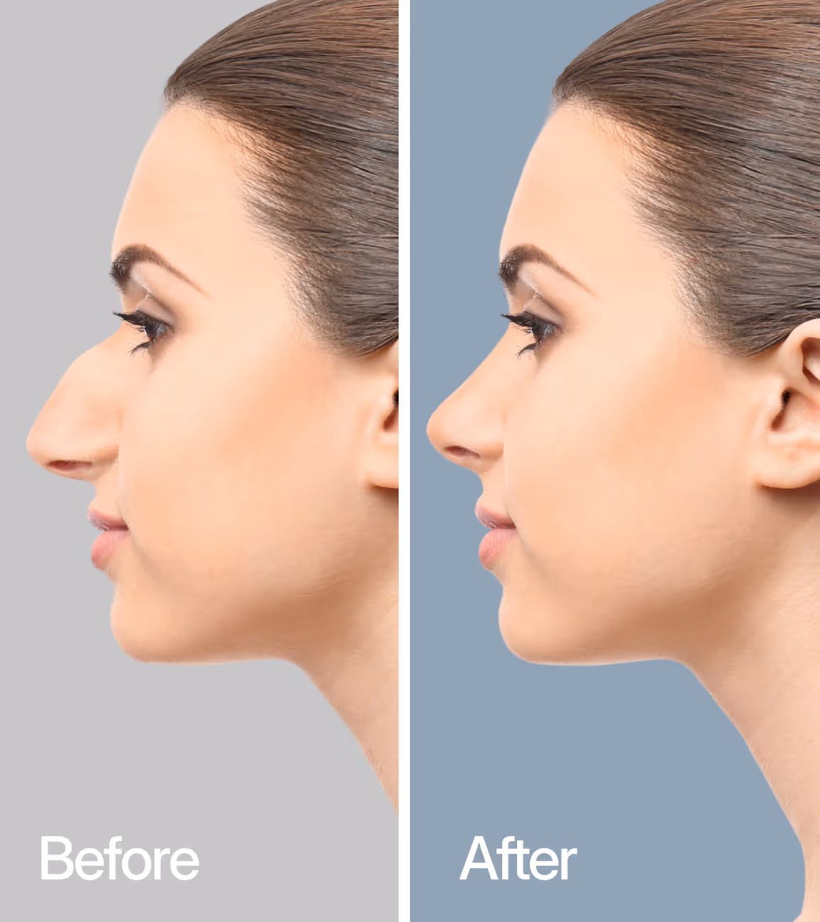 Before And After Dr. Guadalupe Carrillo