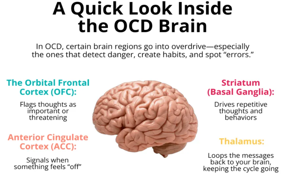 brain and ocd