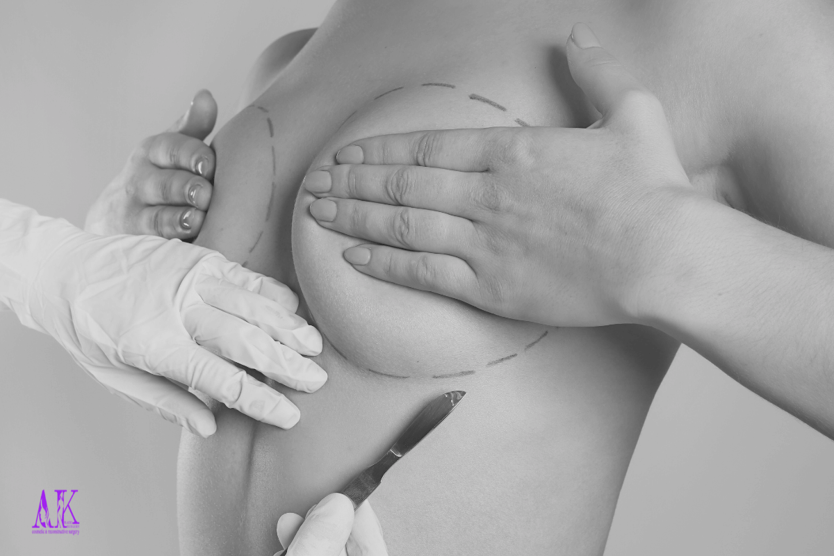 Breast Augmentation Recovery: Complete Week-by-Week Guide in Dubai