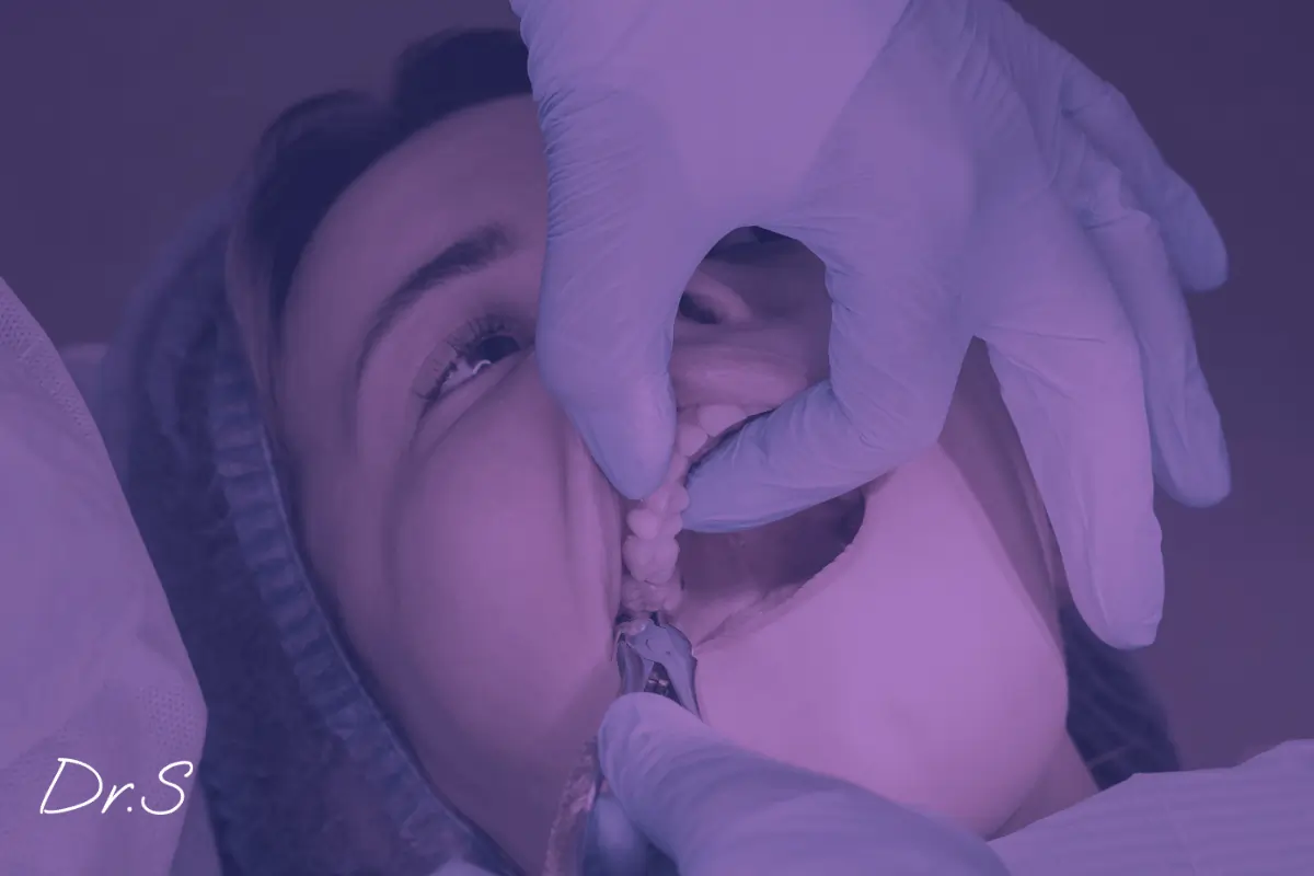 Extraction dentaire : comment se passe l'arrachage d'une dent ?