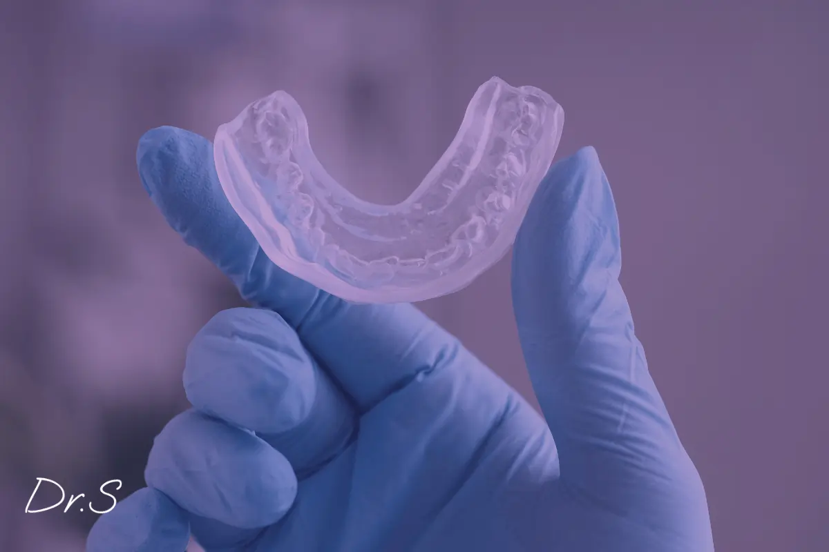 Gouttière pour le bruxisme : solution efficace pour les patients