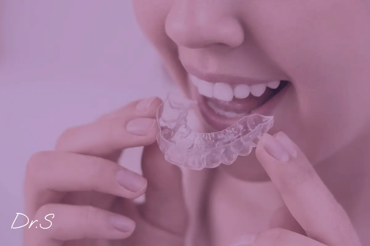 Gouttière pour le bruxisme : solution efficace pour les patients