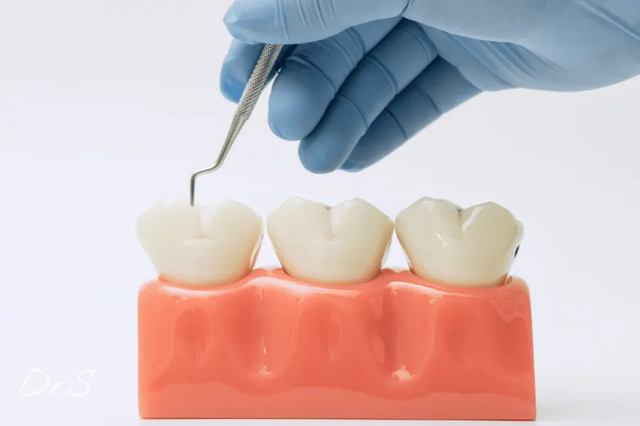 Bouton au palais de la bouche : que signifie-t-il et que faire ?