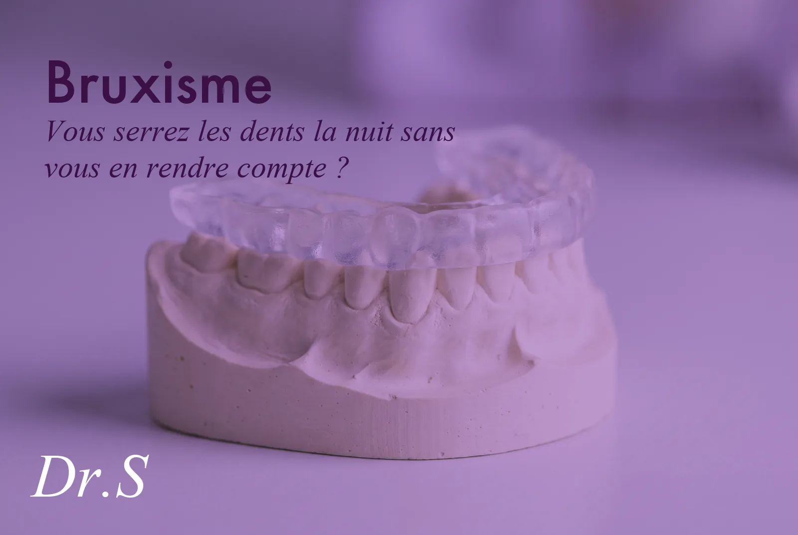 Bruxisme : consultation au cabinet du Dr Solène Vo Quang à Paris